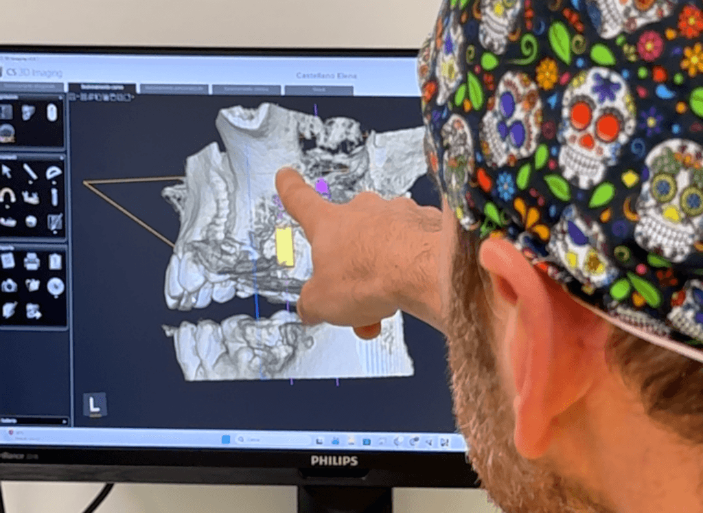 Implantologia dentale dolorosa
