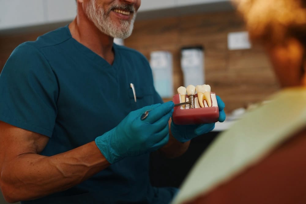 scegliere un impianto dentale